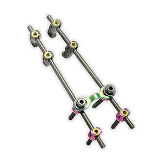 Gibralt Spinal System: image from Exactech